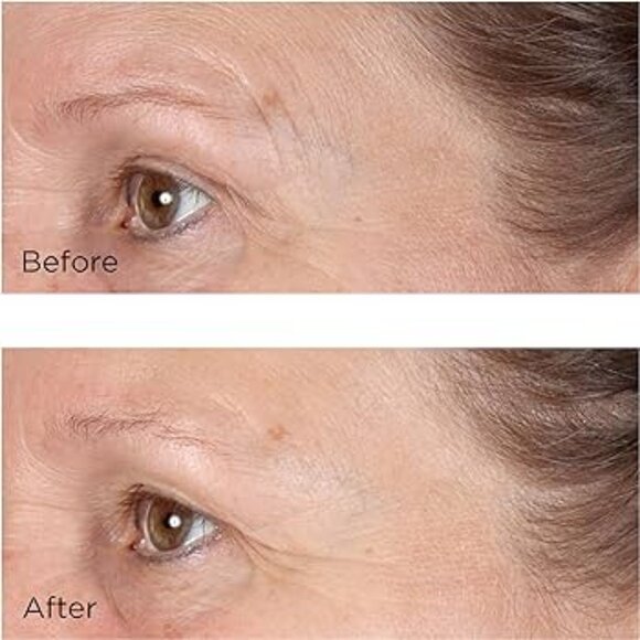 Vitamin C Ester Daily Brightening & Exfoliating Peel NEW IN BOX - Picture 2 of 4